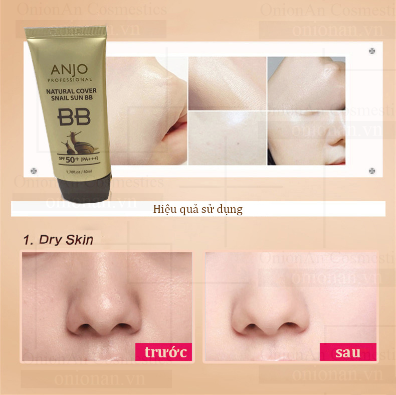 Kem Nền Chống Nắng Ốc Sên Anjo Natural Cover Snail Sun BB SPF50+ PA+++